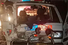 Puttur: Infant injured in ambulance mishap